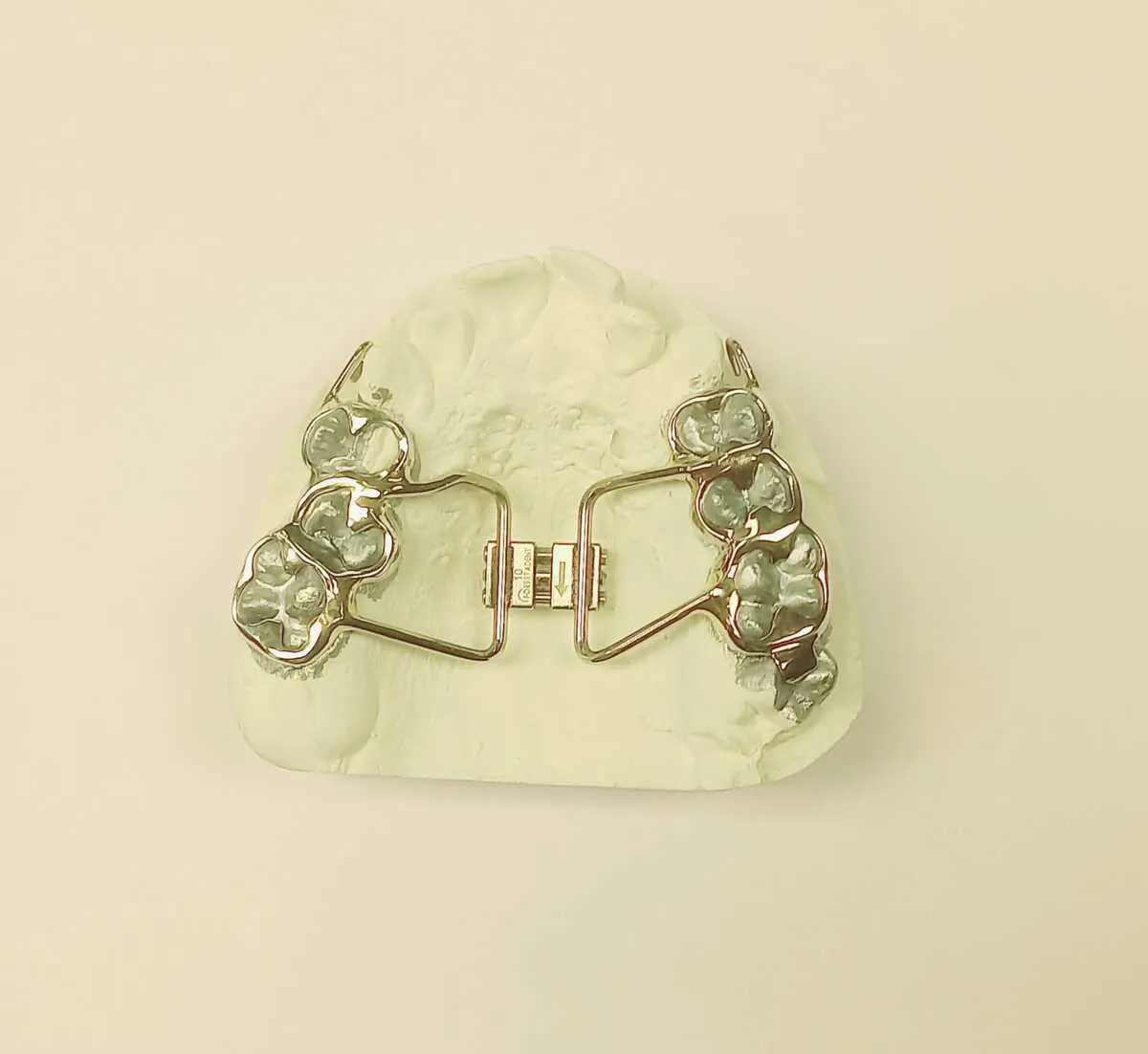 Gaumennahterweiterung (GNE)